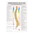 Posters - Spinal therapy Dorn - L x W 70x50 cm