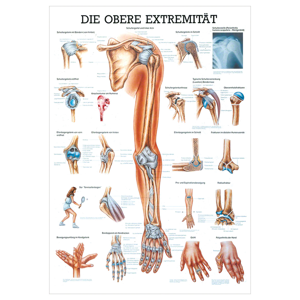 Mini Poster Upper Extremity L X W 34x24 Cm Buy Online Sport Tec