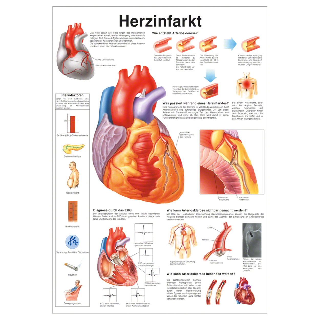 Poster Heart Attack L X W 70x50 Cm Buy Online Sport Tec