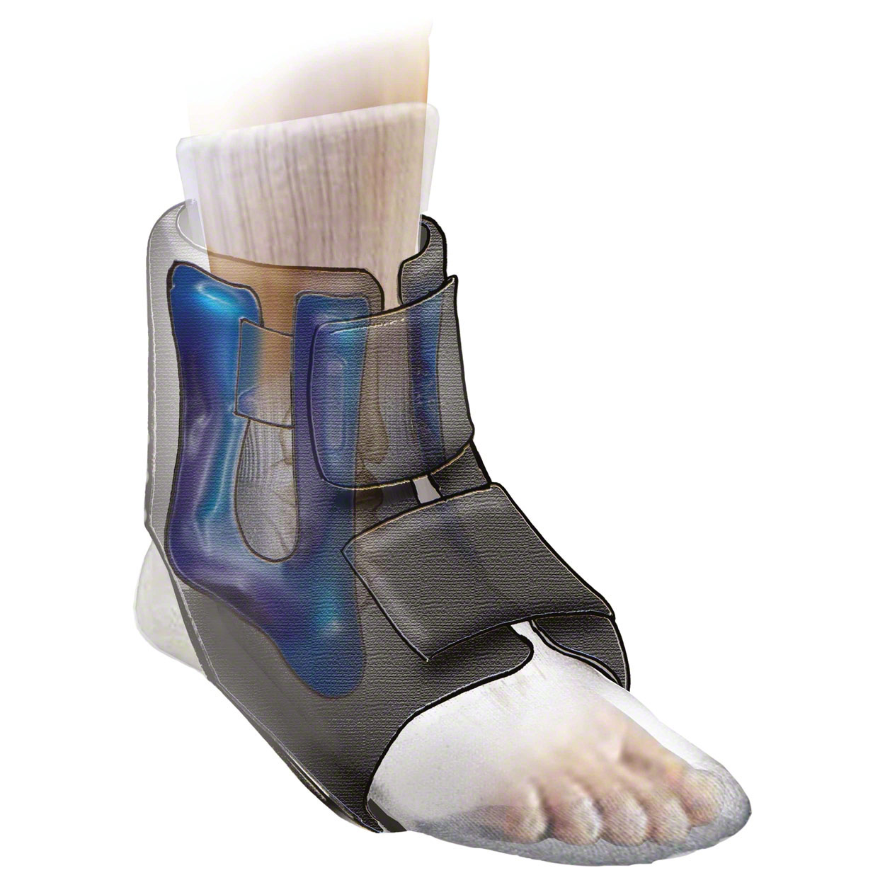 Torex cold / warm compress boot compress MC2 Pro incl. 2 gel inserts