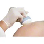 Ultrasound ECHOSON, 10 l
