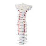 Image shows Spinal column with a disc prolapse incl. stand, 80 cm