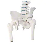 Image shows Spinal column with a disc prolapse incl. stand, 80 cm