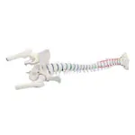 Image shows Spinal column with a disc prolapse incl. stand, 80 cm