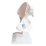 Image shows Hip joint, L x W x H 17 x 17 x 23 cm