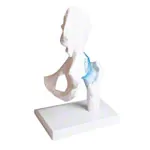 Image shows Hip joint, L x W x H 17 x 17 x 23 cm