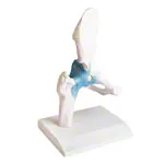 Image shows Hip joint, L x W x H 17 x 17 x 23 cm