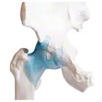 Image shows Hip joint, L x W x H 17 x 17 x 23 cm