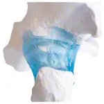 Image shows Hip joint, L x W x H 17 x 17 x 23 cm