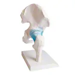 Image shows Hip joint, L x W x H 17 x 17 x 23 cm