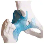 Image shows Hip joint, L x W x H 17 x 17 x 23 cm