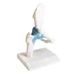 Image shows Hip joint, L x W x H 17 x 17 x 23 cm