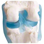 Knee joint, LxWxH 13x13x40 cm