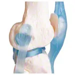 Knee joint, LxWxH 13x13x40 cm