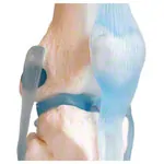 Knee joint, LxWxH 13x13x40 cm