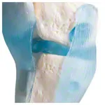 Knee joint, LxWxH 13x13x40 cm