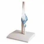 Image shows Elbow joint, LxWxH 28,5x16,5x14,5 cm