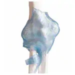 Image shows Elbow joint, LxWxH 28,5x16,5x14,5 cm