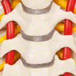 Cervical spine, LxWxH 19x19x25 cm