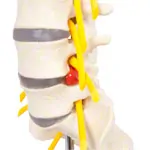 Lumbar spine, LxWxH 19x19x27 cm