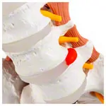 Image shows Male pelvis with lumbar spine and lumbar muscles