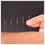 Acupuncture needles with copper spiral handle, 0.20x15 mm