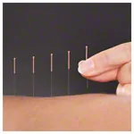 Acupuncture needles with copper spiral handle, 0.22 x 25 mm
