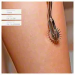 Wartenberg sensory wheel, 17 cm