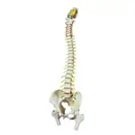 Anatomy set: skull 4-pcs. and spine with herniated disk