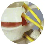Anatomy set: skull 4-pcs. and spine with herniated disk