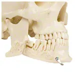 Anatomy set: skull 4-pcs. and spine with herniated disk