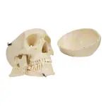 Anatomy set: skull 4-pcs. and spine with herniated disk