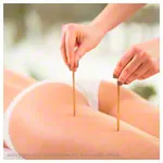 Brass acupressure pin, 15 cm,  4 / 7 mm