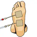 Compex electrodes wire, 5x5 cm, 4 pieces