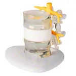 Image shows Herniated disc simulator