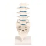 Image shows Lumbar spine, LxWxH 19x19x27 cm