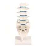 Image shows Lumbar spine with stand
