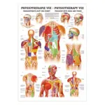 Poster - trigger points head and torso - L x W 70x50 cm