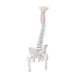 Image shows Spinal column with a disc prolapse incl. stand, 80 cm