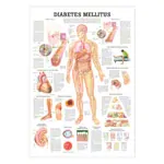 Wall chart - Diabetes Mellitus -, LxW 100x70 cm
