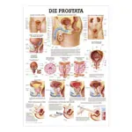 Wall chart - The Prostate - LxW 100x70 cm