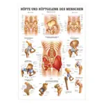 Wall chart - hip and hip joint - , LxW 100x70 cm