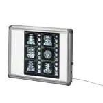 Product image: X-ray film viewer 560 Mediskop, gray corners