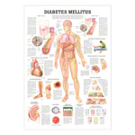 Wall chart - Diabetes Mellitus -, LxW 100x70 cm