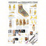 Wall chart - The Foot - , LxW 100x70 cm