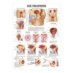 Wall chart - The Prostate - LxW 100x70 cm