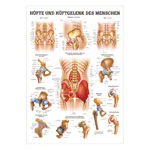 Wall chart - hip and hip joint - , LxW 100x70 cm