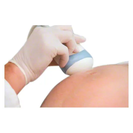 Ultrasound ECHOSON, 10 l
