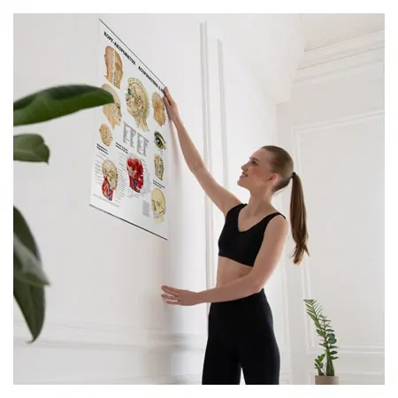 Poster - Head-acupuncture - , L x W 70x50 cm