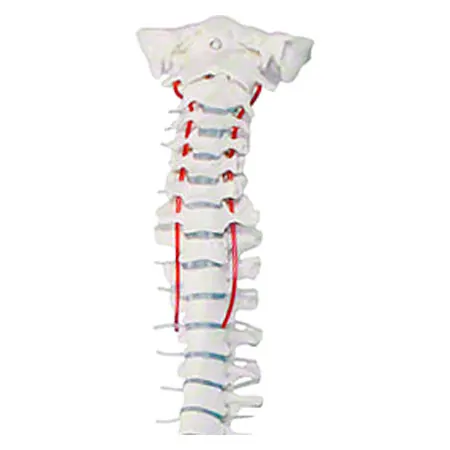 Spinal column with a disc prolapse incl. stand, 80 cm